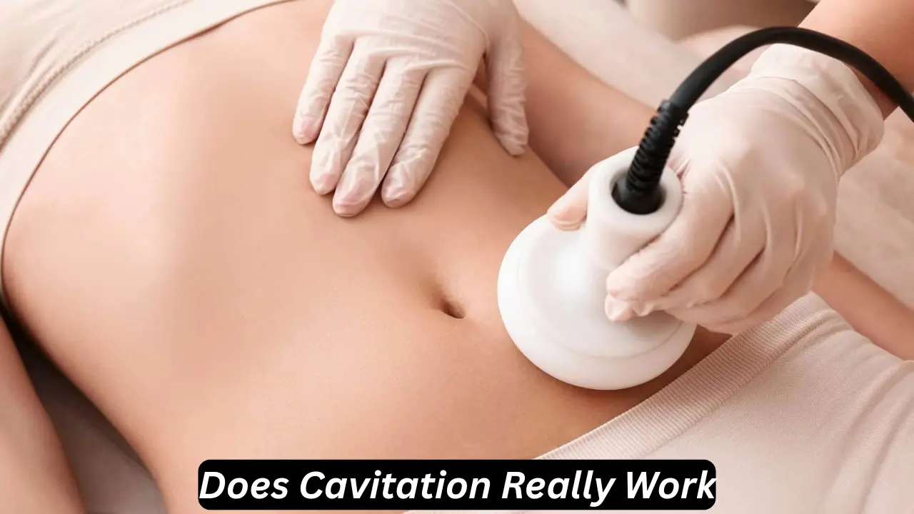 does cavitation really work